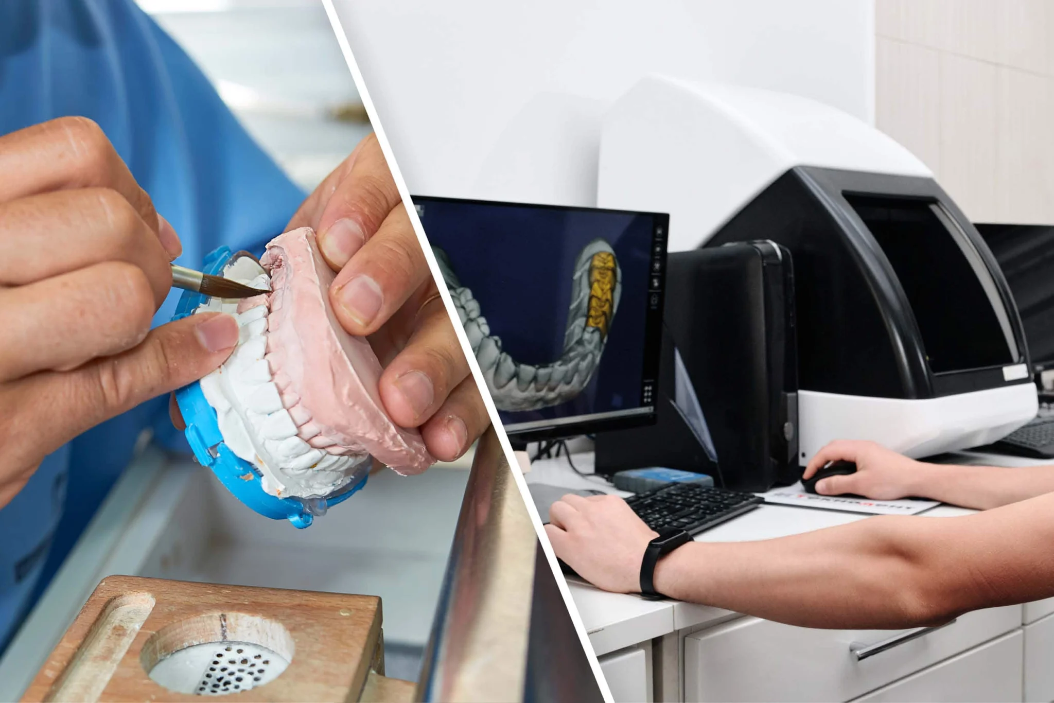 BEST DENTAL TECHNICIAN COURSE CALICUT